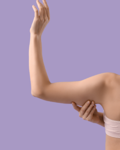 Arm Lift