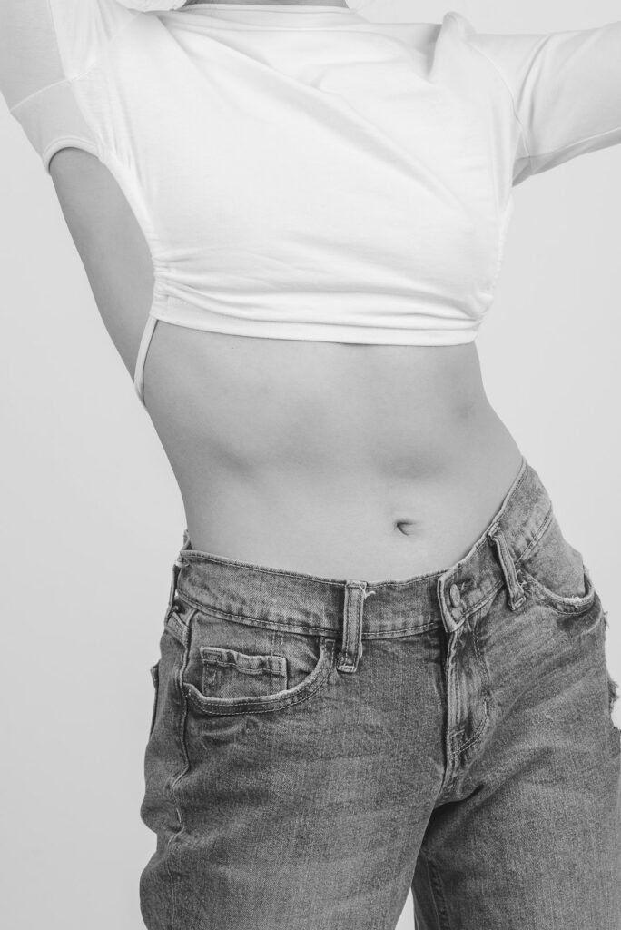 Mini Tummy Tuck in Turkey